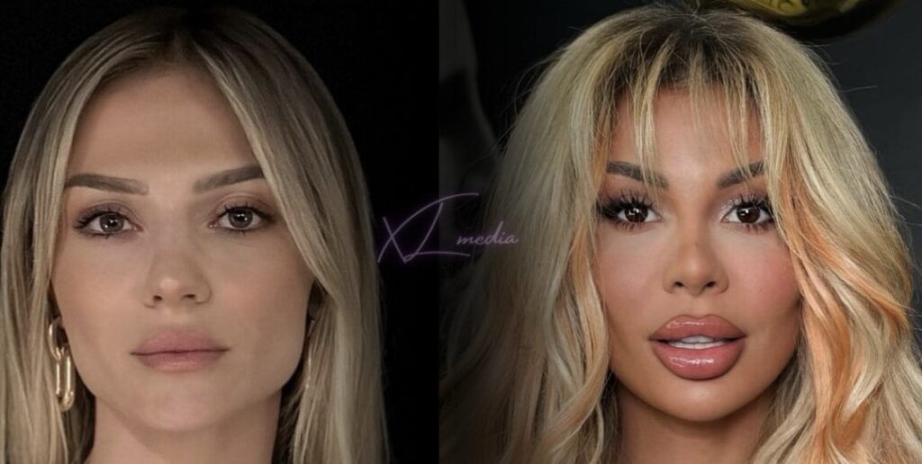 Nita Latifi e thotë hapur: “Luana nuk ka talent në muzikë, është e rëndësishme të…”