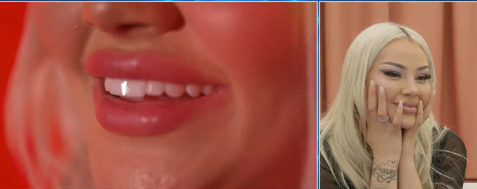 Benita zbulon kush ia pagoi dhëmbët 18 mijë euro