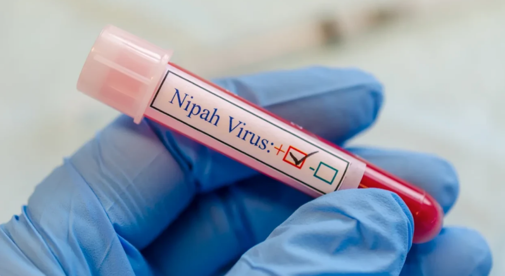 India lufton shpërthimin vdekjeprurës të virusit Nipah