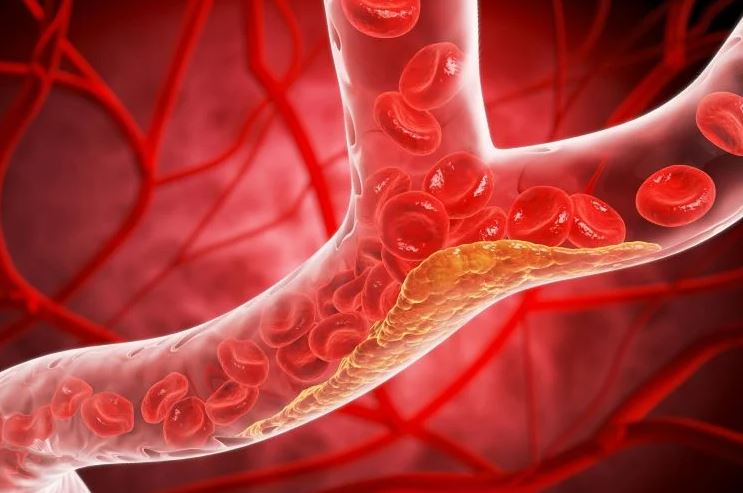 Studimi zbulon se kjo dietë e thjeshtë 48-orëshe ul kolesterolin e dëmshëm me 10% – GAZETA SHËNDETI